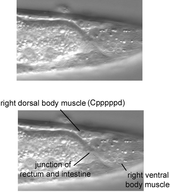 The posterior-most right dorsal body muscle figure 14