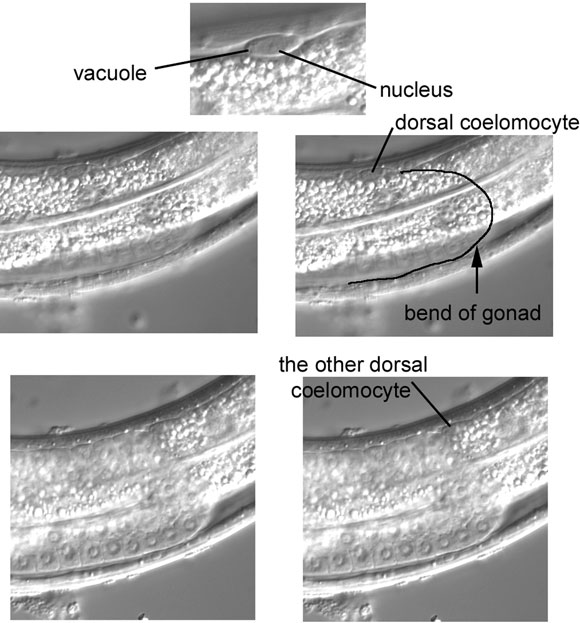 The sometimes elusive dorsal coelomocytes figure 25