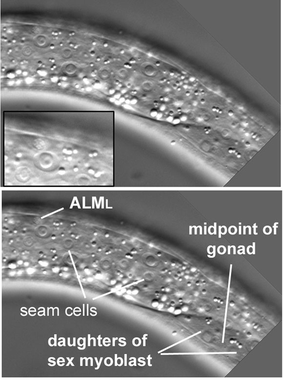 The isolated cell body of the neuron ALML dorsal to and anterior of the anteroposterior midpoint of the gonad figure 36