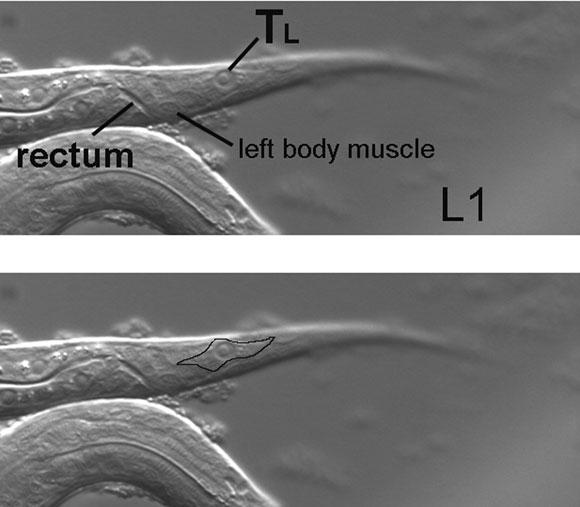 TL, the posterior-most seam cell on the left side of a hatchling figure 8